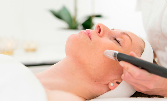 Peeling Químico con Asistencia Láser